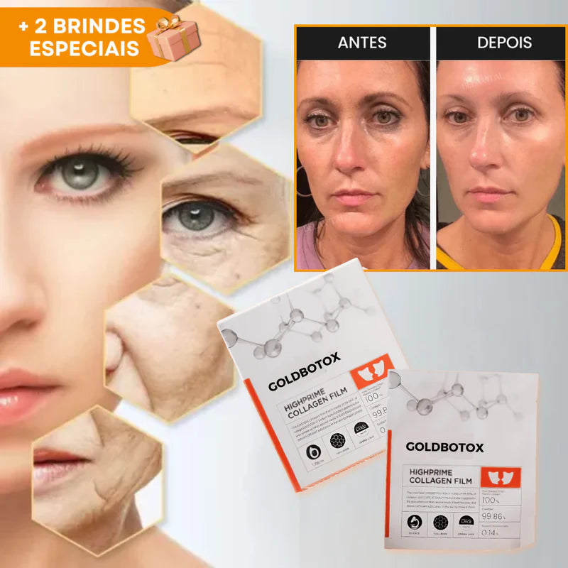 KIT GOLDBOTOX™ HIGHPRIME - COLÁGENO + ACIDO HIALURÔNICO + ATIVO DO BOTOX