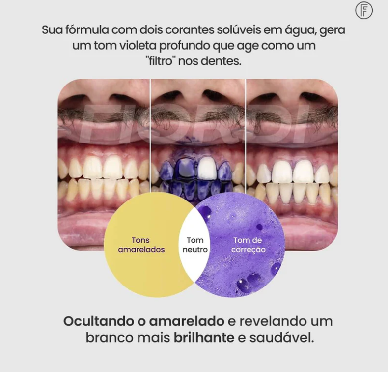 Clareador Dentário - Sérum V34™